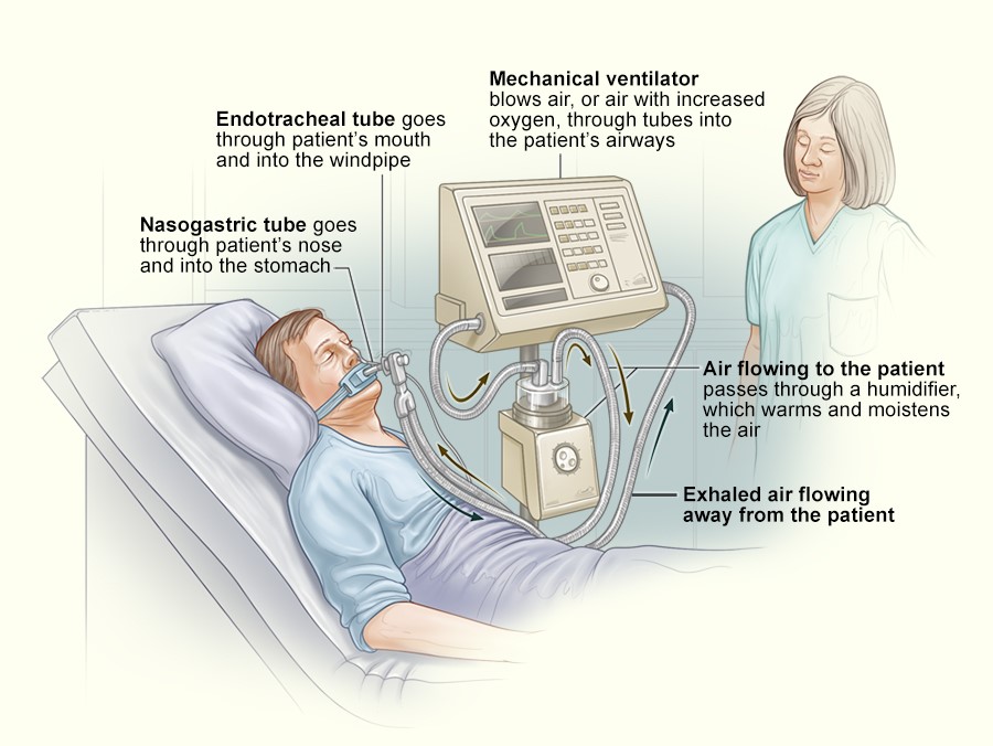 ventilator-19